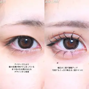 アリエル美容クリニック 大宮院 鈴木　桂介医師の症例