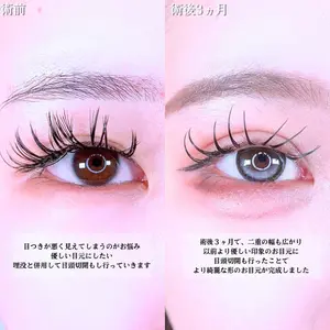 アリエル美容クリニック 水戸院 天白 典秀医師の症例