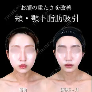 アリエル美容クリニック 横浜院 渡邉 光医師の症例
