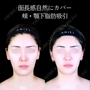 アリエル美容クリニック 郡山院 安齋 誠基医師の症例