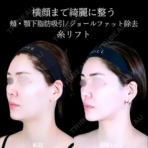 アリエル美容クリニック 郡山院 安齋 誠基医師の症例