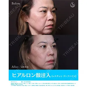 聖心美容クリニック 横浜院 佐々木 直美医師の症例