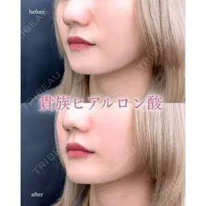 ルラ美容クリニック 町田院 松岡 舟作医師の症例