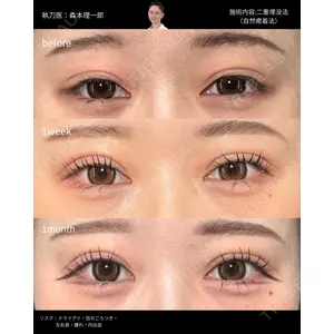PRISM Beauty Clinic 町田院 森本 理一郎医師の症例