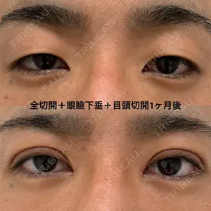 エターナル美容クリニック 久門田 詳医師の症例