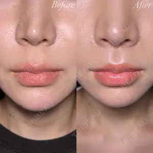 R Beauty CLINIC 大阪院 小池 泰弘医師の症例