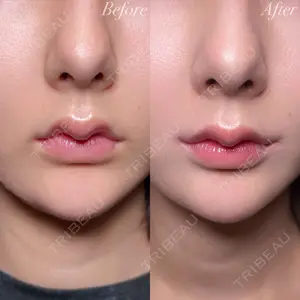 R Beauty CLINIC 大阪院 小池 泰弘医師の症例