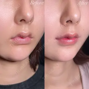 R Beauty CLINIC 大阪院 小池 泰弘医師の症例