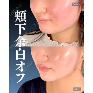 神戸美容外科 ネビュラクリニック 岩﨑 雅医師の症例