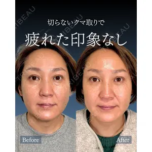 神戸美容外科 ネビュラクリニック 岩﨑 雅医師の症例
