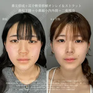 ASTRA BEAUTY CLINIC 塩満 惠子医師の症例