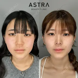 ASTRA BEAUTY CLINIC 塩満 惠子医師の症例