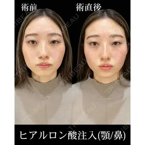 HAAB×DREAM BEAUTY CLINIC 東京本院 佐野 圭医師の症例