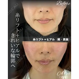 HAAB BEAUTY CLINIC 南青山本院（新院） 桂田 凛医師の症例