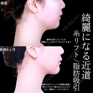 アリエル美容クリニック 水戸院 天白 典秀医師の症例