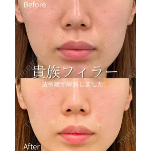 ルラ美容クリニック 仙台院 / ルラスキンクリニック 仙台院 橋本 英樹医師の症例