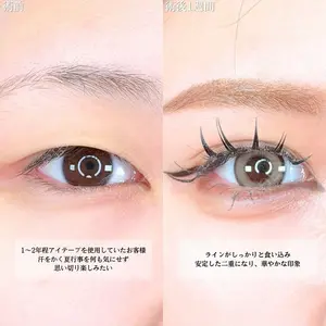 アリエル美容クリニック 横浜院 渡邉 光医師の症例