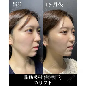 HAAB CLINIC 池袋院 野田 裕太郎　医師の症例