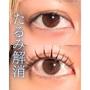 神戸美容外科 ネビュラクリニック 岩﨑 雅医師の症例