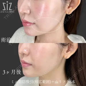 ziz CLINIC 村岡 史子医師の症例