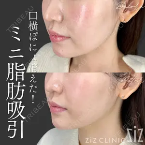ziz CLINIC 村岡 史子医師の症例