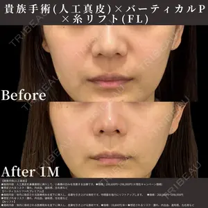 EMMO FACE CLINIC 東京三田院 木之下 哲彦医師の症例