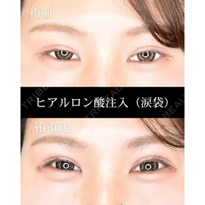 HAAB CLINIC 福岡院 米谷 拓朗医師の症例