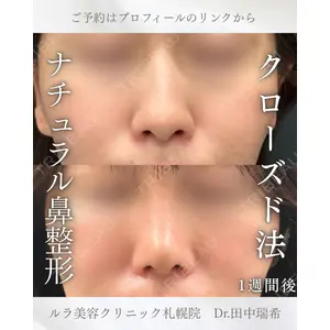 ルラ美容クリニック 札幌本院 田中 瑞希医師の症例