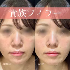 ルラライト美容クリニック 八王子院 桑野 淳医師の症例