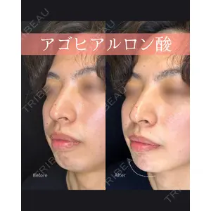 ルラライト美容クリニック 八王子院の症例