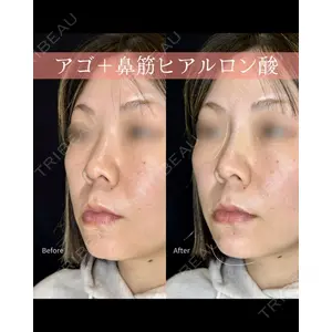 ルラライト美容クリニック 八王子院 桑野 淳医師の症例