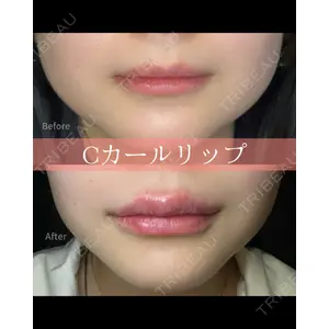 ルラライト美容クリニック 八王子院の症例