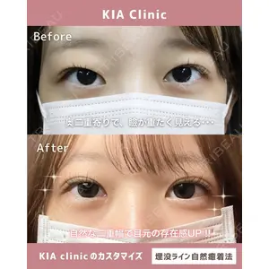 KIA CLINIC 心斎橋院 雲山　盛秀医師の症例