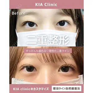 KIA CLINIC 心斎橋院 雲山　盛秀医師の症例