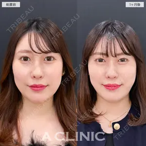 A CLINIC（エークリニック） 新宿院 瀬戸　翔太医師の症例