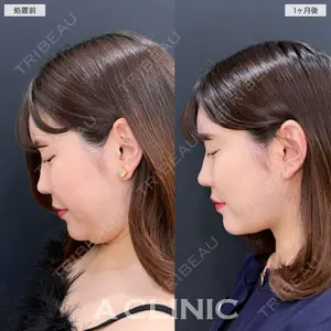A CLINIC（エークリニック） 新宿院 瀬戸　翔太医師の症例