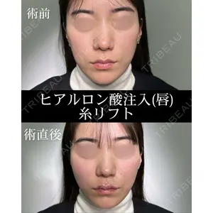 HAAB×DREAM BEAUTY CLINIC 大阪梅田院 錦 実奈医師の症例