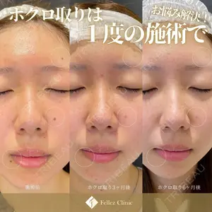 Fellez Clinic【フェルズクリニック】の症例