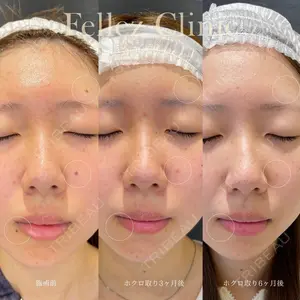 Fellez Clinic【フェルズクリニック】の症例