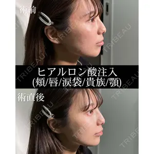 HAAB×DREAM BEAUTY CLINIC 大阪梅田院 錦 実奈医師の症例