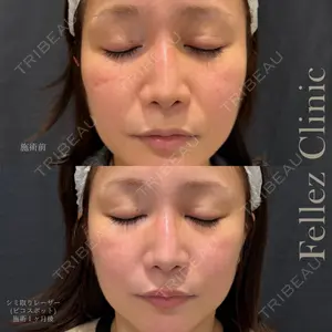Fellez Clinic【フェルズクリニック】の症例