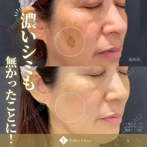 Fellez Clinic【フェルズクリニック】の症例