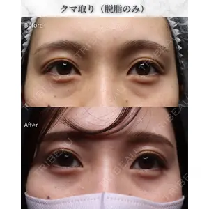 吉祥寺アイビークリニック 升本 浩紀医師の症例