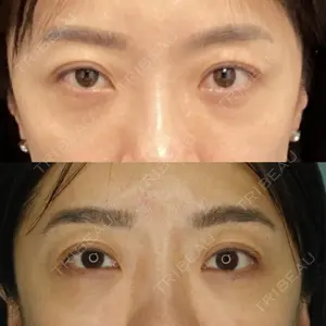 ギャラリークリニック 銀座 中川剛医師の症例