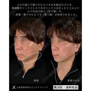 小倉美容外科ネビュラクリニック 浦野 正樹医師の症例