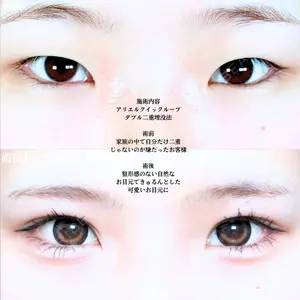 アリエル美容クリニック 大宮院 江郷隼一郎医師の症例