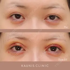 KAUNIS CLINIC（カウニスクリニック）の症例