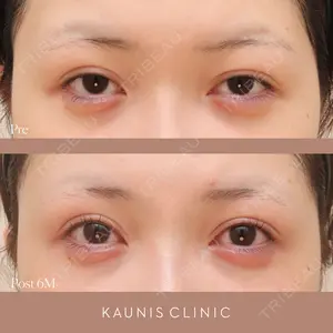 KAUNIS CLINIC（カウニスクリニック）の症例