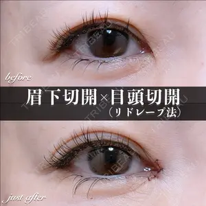 EMMO FACE CLINIC 大宮院 百瀬 直也医師の症例