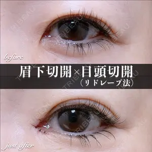 EMMO FACE CLINIC 大宮院 百瀬 直也医師の症例